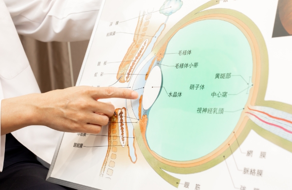 緑内障手術 Glaucoma Surgery