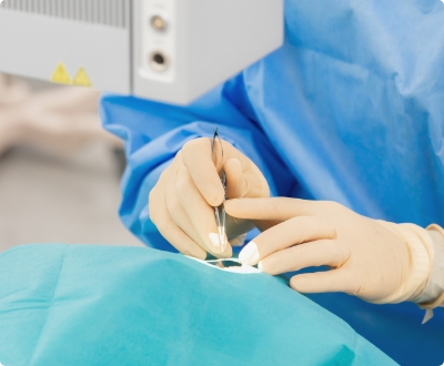 緑内障手術の豊富な経験