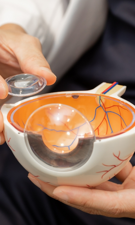 レーザー治療 Laser Treatment