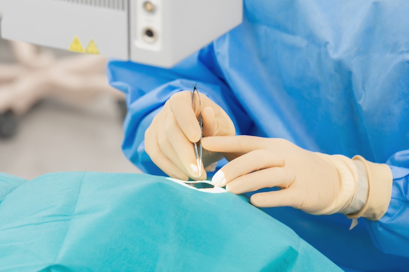 白内障手術のこだわりは？