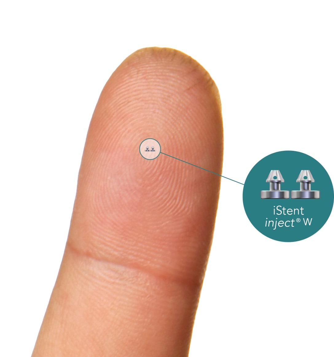 iStent inject®
