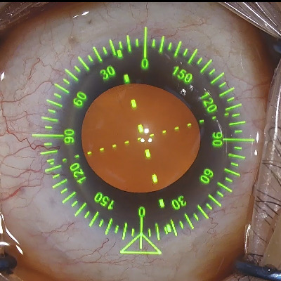 ベリオンデジタルマーキング