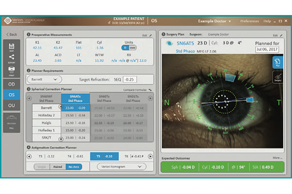 光学式眼軸長測定器「ARGOS」